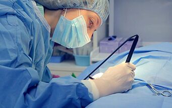 Hirurg koji izvodi operaciju povećanja falusa muškarca