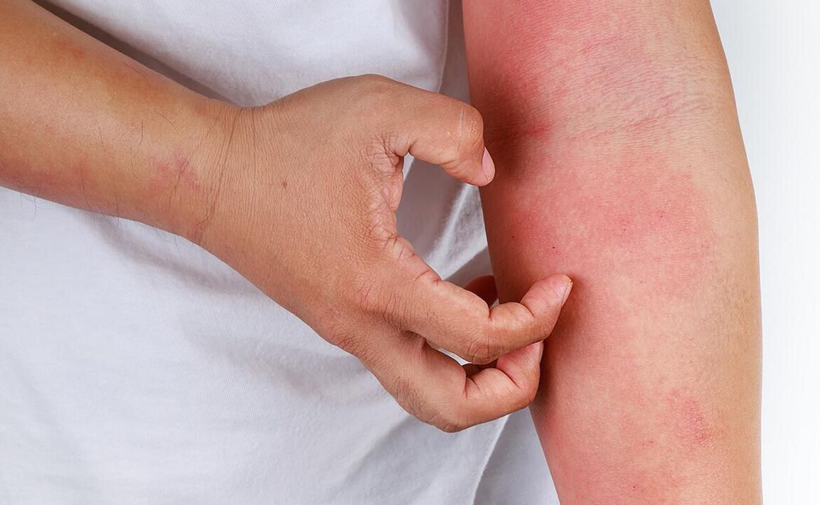 moguće komplikacije od upotrebe sode